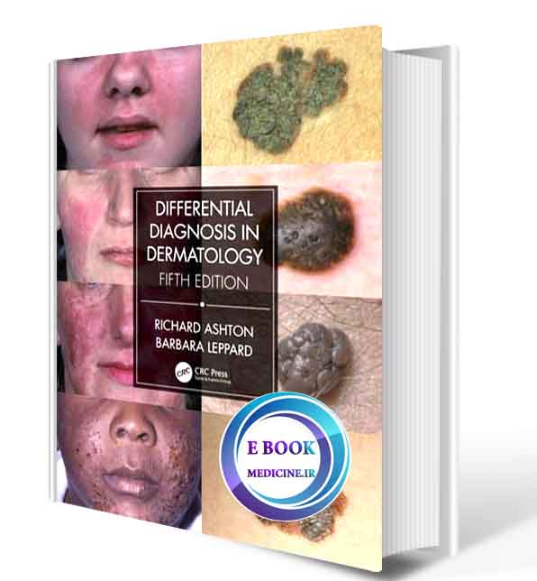 دانلود کتابDifferential Diagnosis in Dermatology 5th  2021 (ORIGINAL PDF)